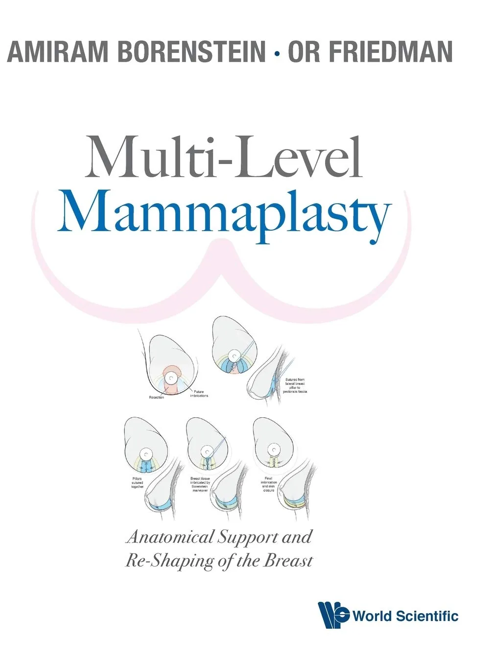 Multi-Level Mammaplasty